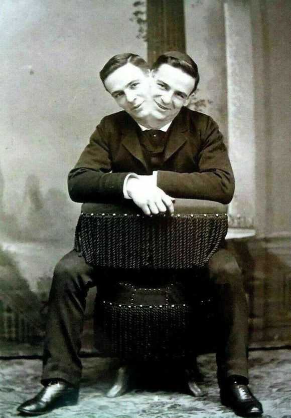 POSTCARD / BONINE, R.A. / Two-headed man, 1900